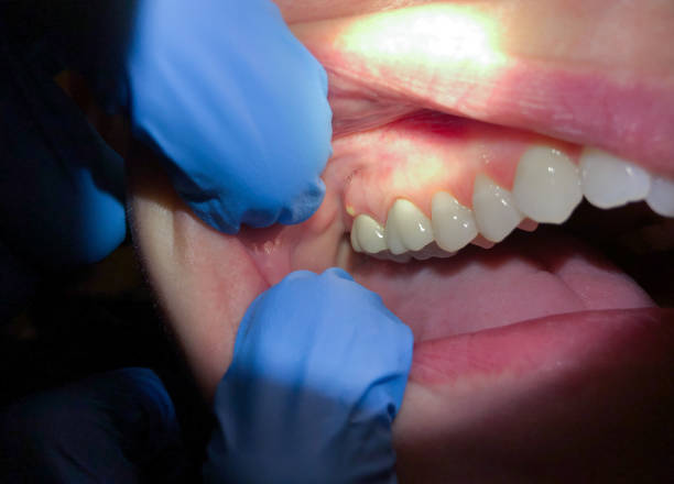 Best Emergency TMJ Treatment in Minor, AL